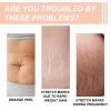 Wiieey Snail Essence Pregnancy Stretch Mark Cream, Firming Skin Lighten Postpartum Pregnancy Marks And Gestational Fat Smoothing Cream