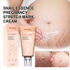 Wiieey Snail Essence Pregnancy Stretch Mark Cream, Firming Skin Lighten Postpartum Pregnancy Marks And Gestational Fat Smoothing Cream